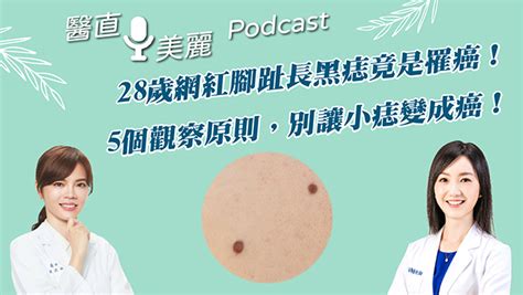 屁股長黑痣|別輕忽！屁股小黑痣越長越大 就醫才發現是癌